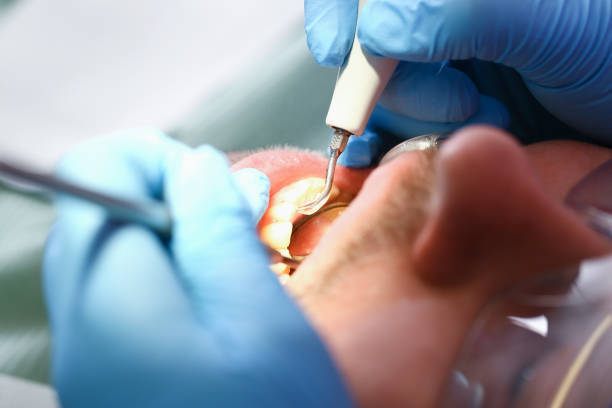Best Emergency Dentist for Knocked-Out Tooth in Middletown, NY